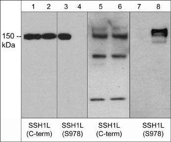 Anti-Slingshot-1L (C-terminal region) Antibody