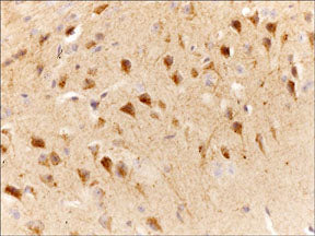 Anti-Slingshot-1L (C-terminal region) Antibody - Image 2