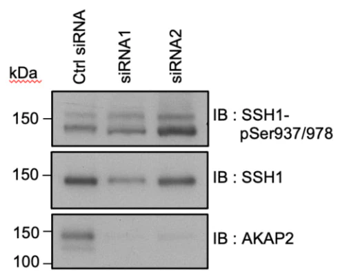 Anti-Slingshot-1L (Ser-978), Phosphospecific Antibody - Image 3