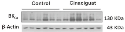 Anti-Slo1 Maxi-K+ Channel Antibody - Image 3