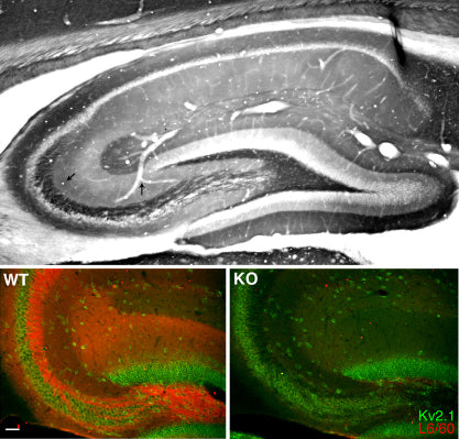 Anti-Slo1 Maxi-K+ Channel Antibody - Image 4