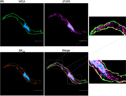 Anti-Slo1 Maxi-K+ Channel Antibody - Image 7