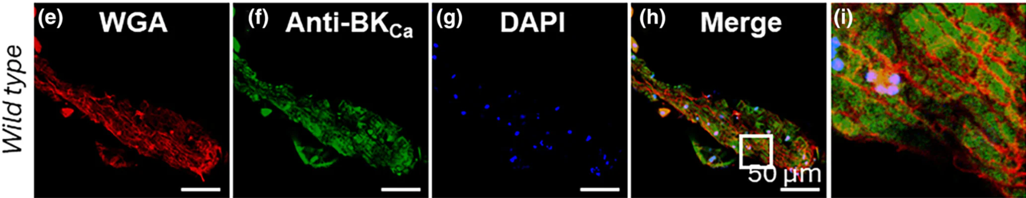 Anti-Slo1 Maxi-K+ Channel Antibody - Image 8