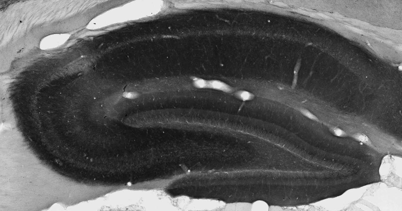 Anti-Slo2.1/Slick K+ Channel Antibody - Image 2