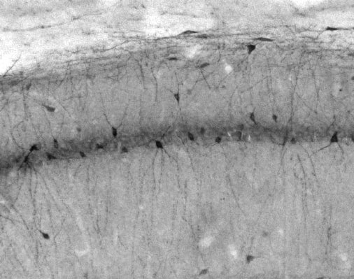 Anti-Slo2.2/Slack K+ Channel Antibody