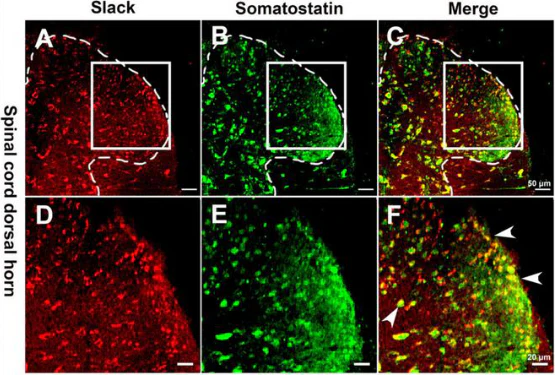 Anti-Slo2.2/Slack K+ Channel Antibody - Image 2