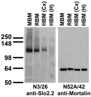 Anti-Slo2.2/Slack K+ Channel Antibody - Image 3