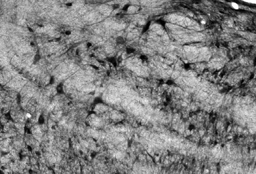 Anti-Slo2.2/Slack K+ Channel Antibody - Image 4