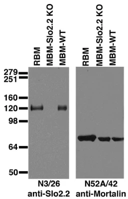 Anti-Slo2.2/Slack K+ Channel Antibody - Image 6