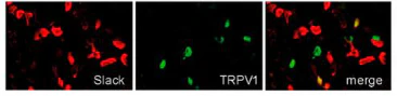 Anti-Slo2.2/Slack K+ Channel Antibody - Image 7