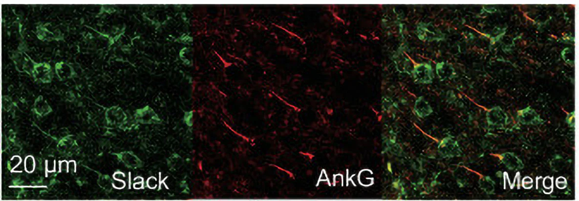 Anti-Slo2.2/Slack K+ Channel Antibody - Image 8
