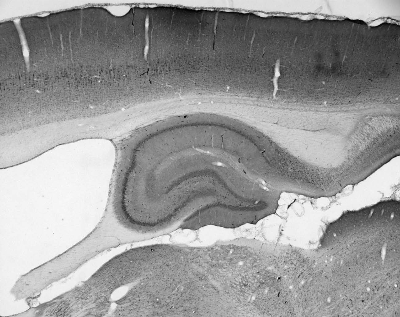 Anti-Snapin/SNAPAP Antibody - Image 2