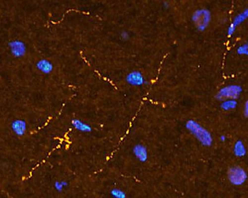 Anti-Somatostatin Antibody