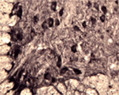 Anti-Sortilin Antibody - Image 2