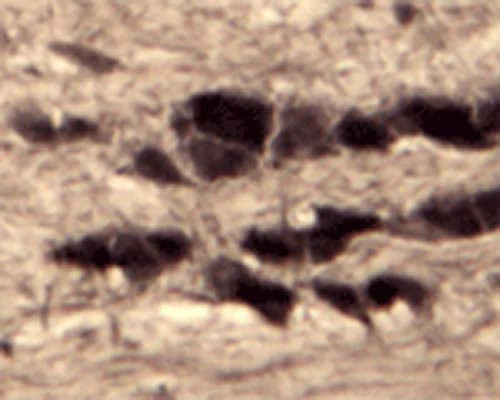 Anti-Sortilin Antibody - Image 3