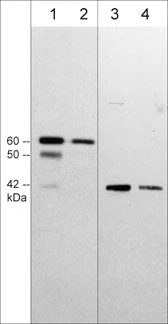 Anti-Sphingosine Kinase 1 (C-terminal region) Antibody