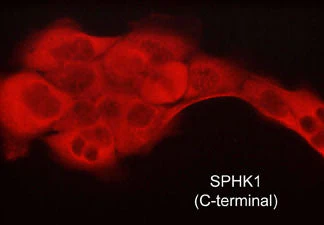 Anti-Sphingosine Kinase 1 (C-terminal region) Antibody - Image 2