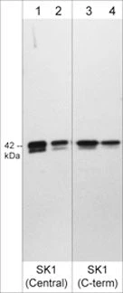Anti-Sphingosine Kinase 1 (C-terminal region) Antibody