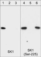 Anti-Sphingosine Kinase 1 (Ser-225), Phosphospecific Antibody