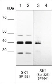 Anti-Sphingosine Kinase 1 (Ser-225), Phosphospecific Antibody - Image 2