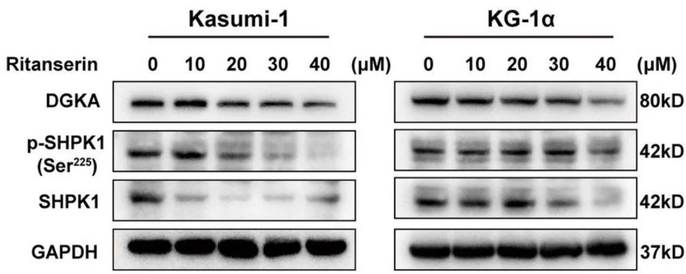 Anti-Sphingosine Kinase 1 (Ser-225), Phosphospecific Antibody - Image 3