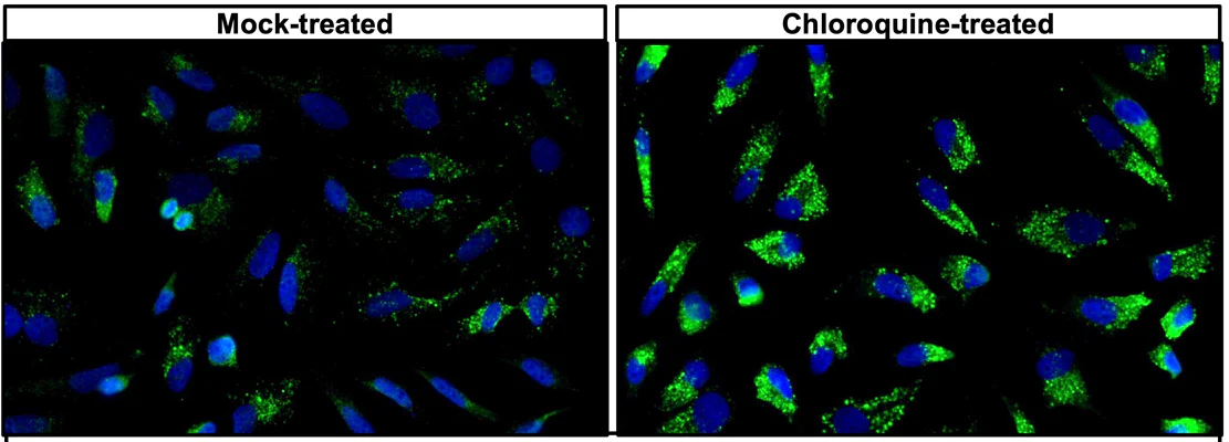 Anti-SQSTM1 Antibody