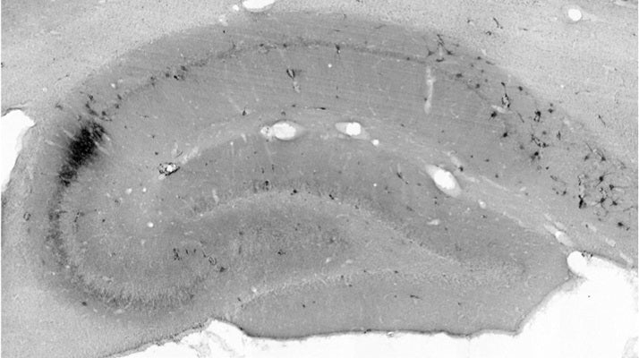 Anti-SST/Somatostatin Antibody