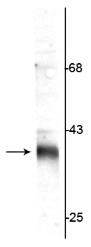 Anti-Stargazin Antibody