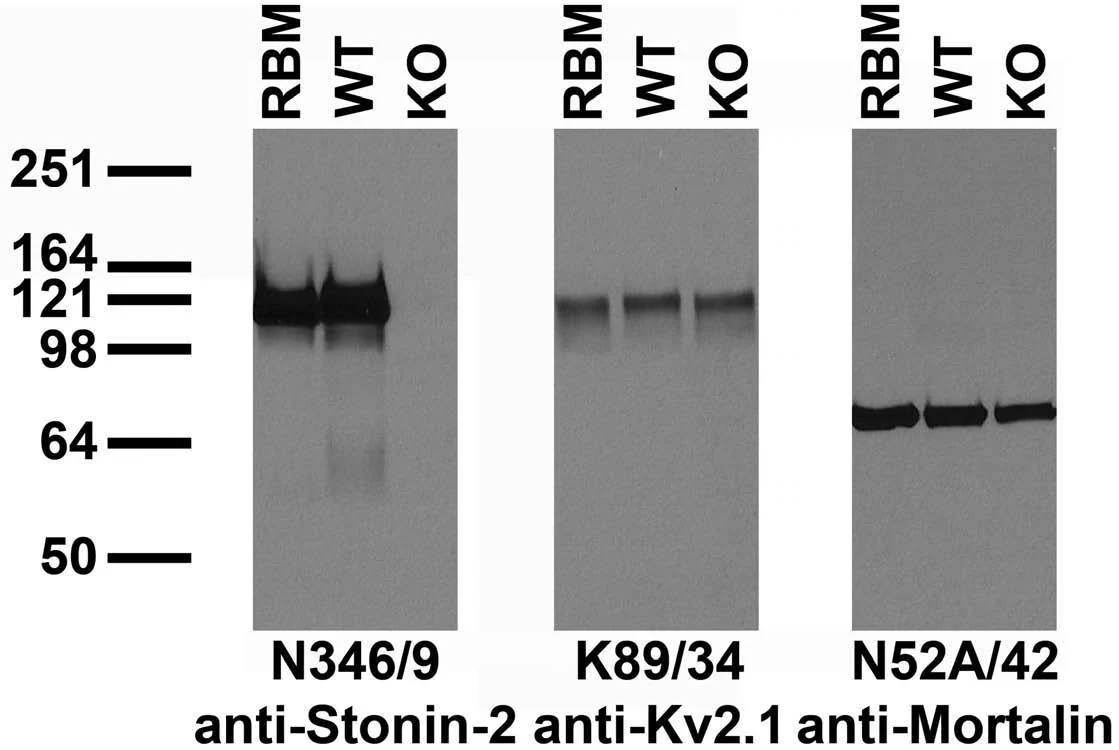 Anti-Stonin-2 Antibody - Image 2
