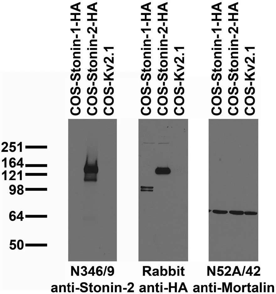 Anti-Stonin-2 Antibody - Image 3