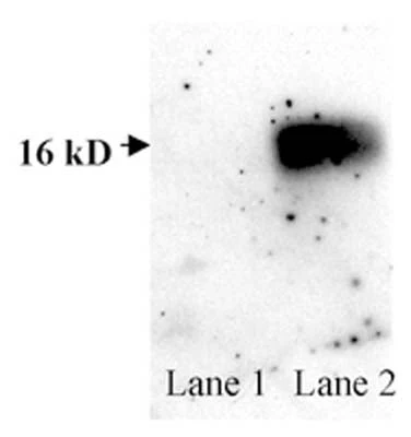 Anti-Superoxide dismutase 1 (SOD1) Antibody