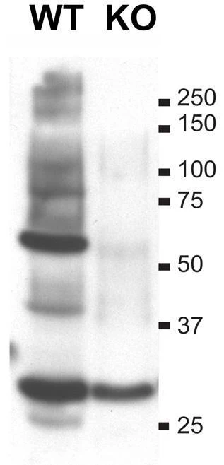 Anti-SUR1 and SUR2B Antibody