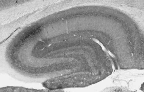 Anti-SUR1 Antibody - Image 2
