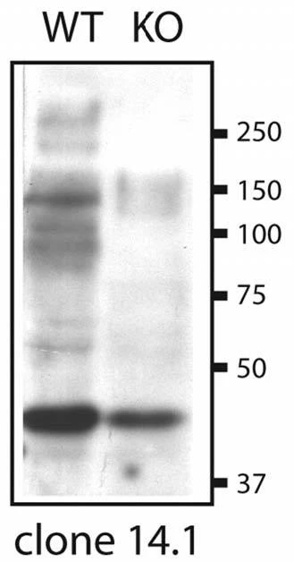 Anti-SUR2A Antibody