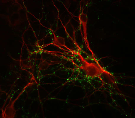 Anti-Synapsin I Antibody - Image 2