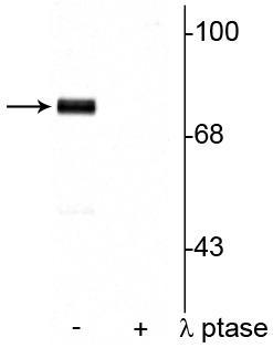 Anti-Synapsin I (Ser9) Antibody - Image 2