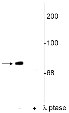 Anti-Synapsin (Ser549) Antibody