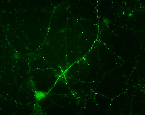 Anti-Synapsin (Ser549) Antibody - Image 2