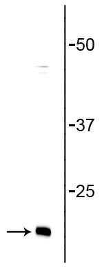 Anti-Synaptobrevin (VAMP) Antibody