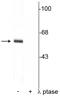 Anti-Synaptotagmin (Thr202) Antibody - Image 2