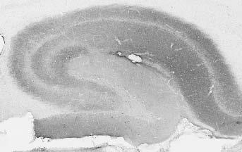 Anti-SynDIG4 Antibody