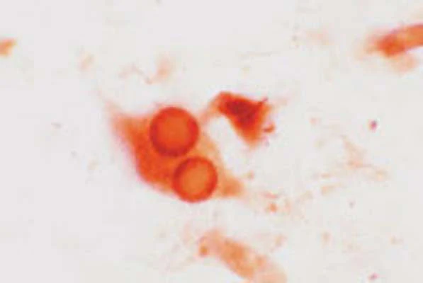 Anti-Synphilin-1 (Sph1) Antibody