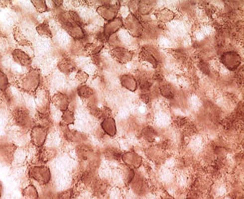 Anti-Synuclein, pan Antibody