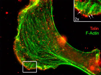 Anti-Talin (Rod domain) Antibody - Image 2