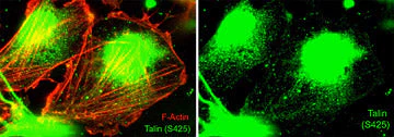 Anti-Talin (Ser-425), Phosphospecific Antibody - Image 2