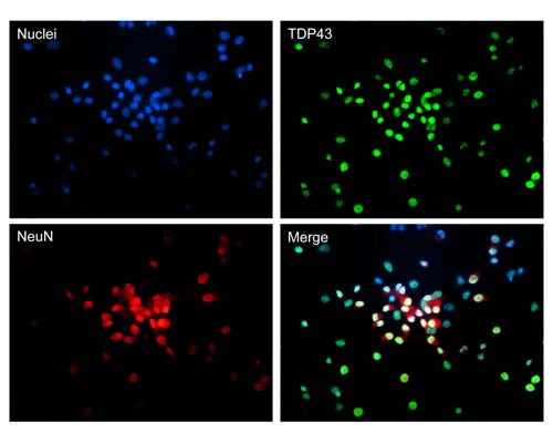 Anti-TAR DNA-binding protein 43 (TDP-43) Antibody - Image 5