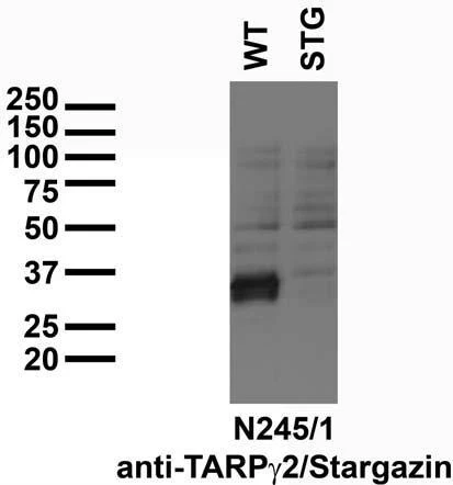Anti-TARPGamma2/Stargazin Antibody