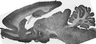 Anti-TASK1 Potassium Channel Antibody