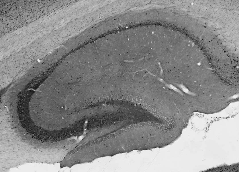 Anti-TASK1 Potassium Channel Antibody - Image 2