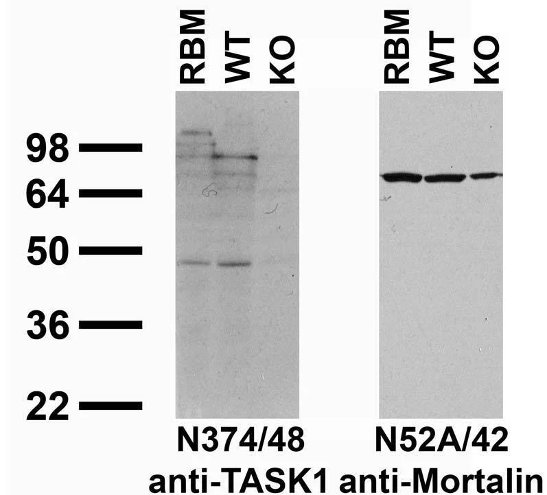 Anti-TASK1 Potassium Channel Antibody - Image 3